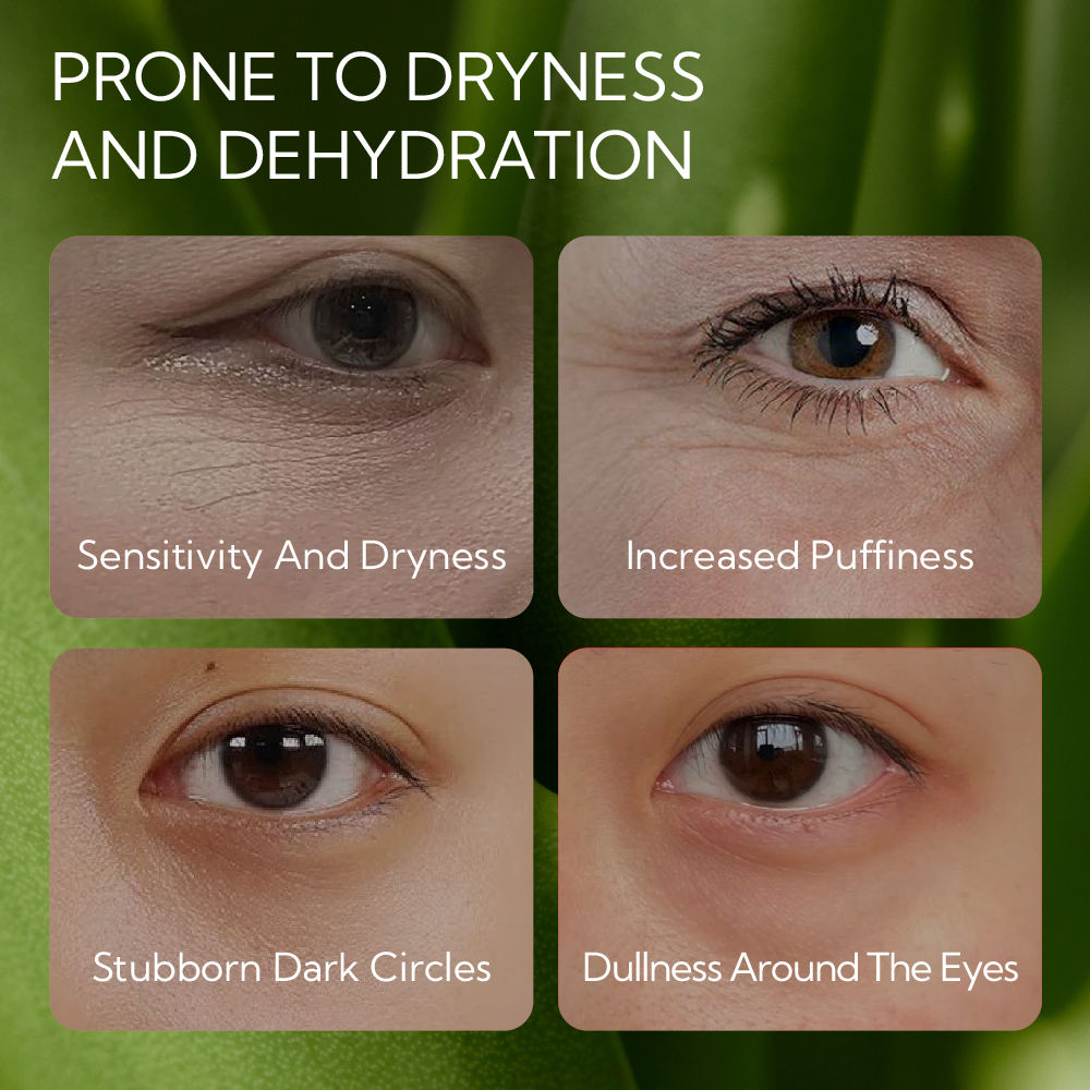 LANBENA Aloe Vera Hydra-Gel Eye Patches with Collagen – Anti-Wrinkle & Dark Circle Care