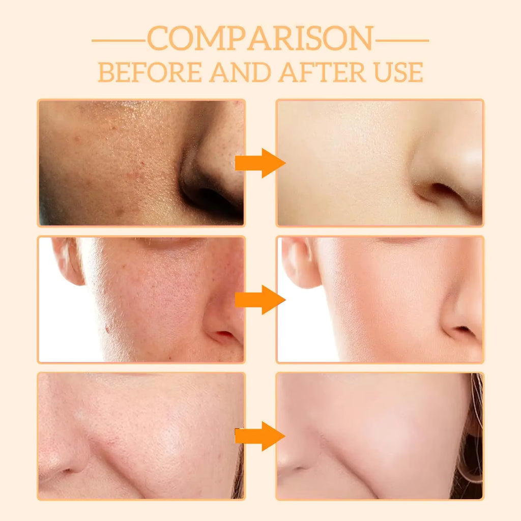 Vitamin C Face Serum – Brightening Anti-Aging Formula with Hyaluronic Acid & Vitamin E